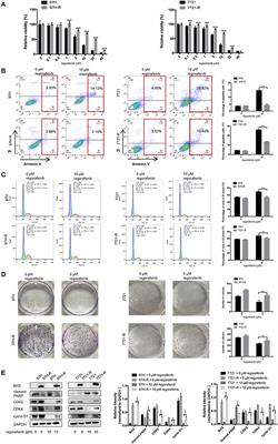 Targeting SphK2 Reverses Acquired Resistance of Regorafenib in Hepatocellular Carcinoma